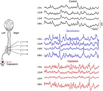 Markovian Analysis of the Sequential Behavior of the Spontaneous Spinal Cord Dorsum Potentials Induced by Acute Nociceptive Stimulation in the Anesthetized Cat